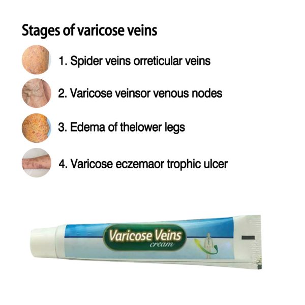 Varicose Cream - Image 4