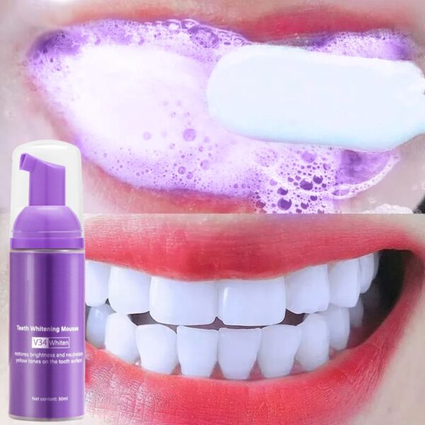 Remove Smoke Stains From Teeth Oral Care Teeth Mousse - Image 5