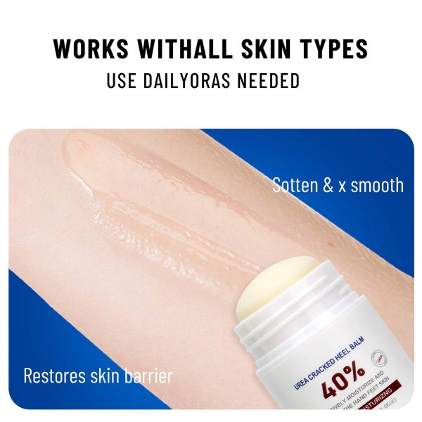 Cross-border Urea Cream 40 Heel Crack Repair Neck Cream - Image 5