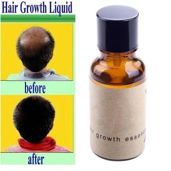 Hair growth liquid - Image 4
