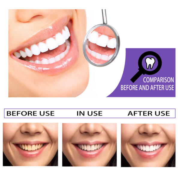 Teeth Whitening Toothpaste Whitening Teeth Removal - Image 6
