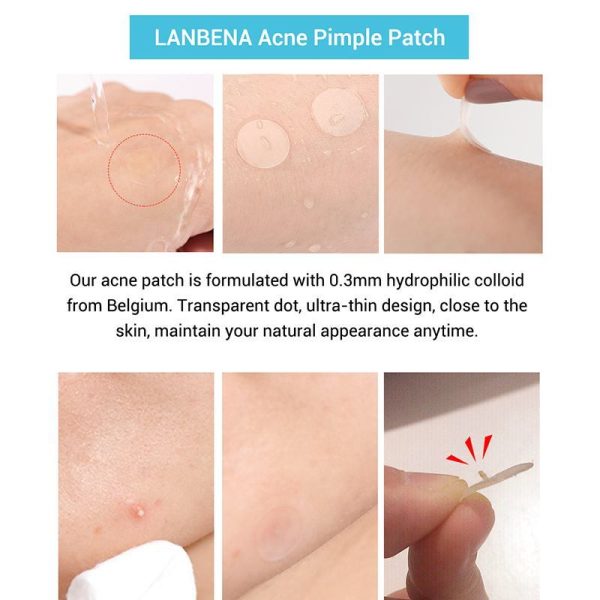 Acne stickers, fade, acne marks - Image 4