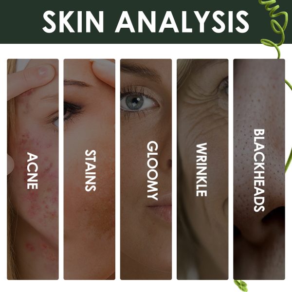 Acne Marks Blackhead Brightening Skin - Image 6