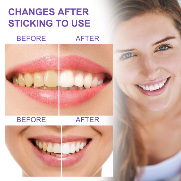 Teeth Whitening Toothpaste Whitening Teeth Removal - Image 7