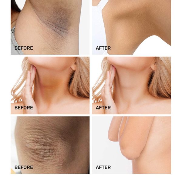 Men's And Women's Underarm Brightening Cream - Image 7