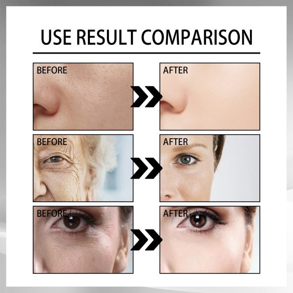 Anti-Aging Moisturizing Snail Cream 100g: Target Wrinkles and Boost Hydration - Image 4