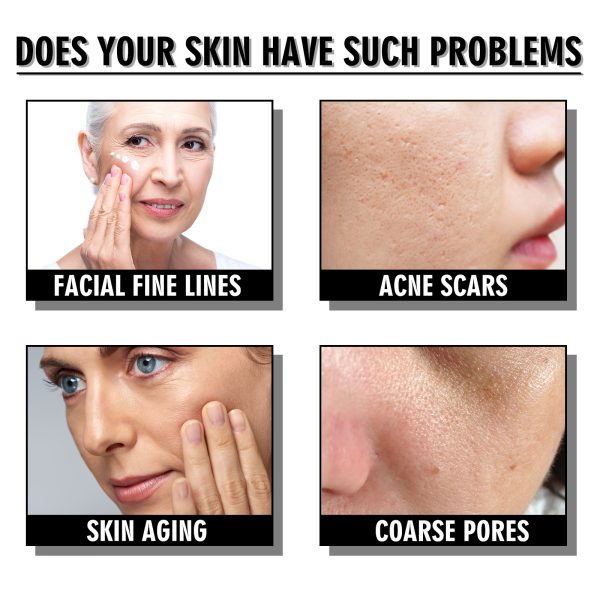 Anti-Aging Moisturizing Snail Cream 100g: Target Wrinkles and Boost Hydration - Image 3